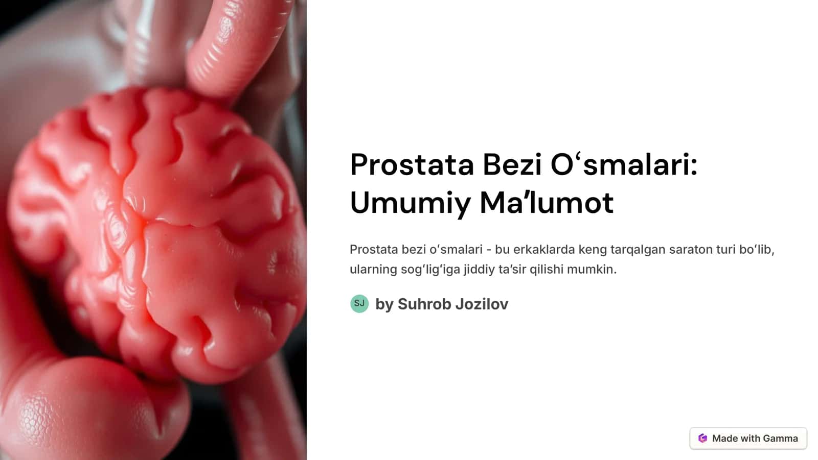 Prostata Bezi Oʻsmalari
