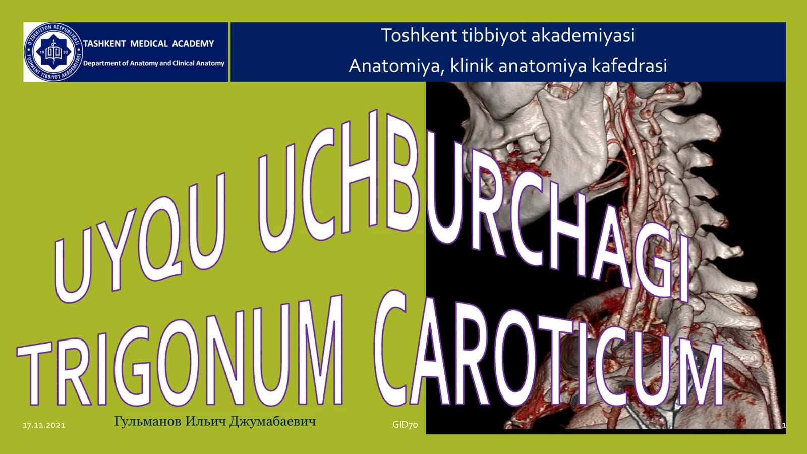 Uyqu uchburchagi