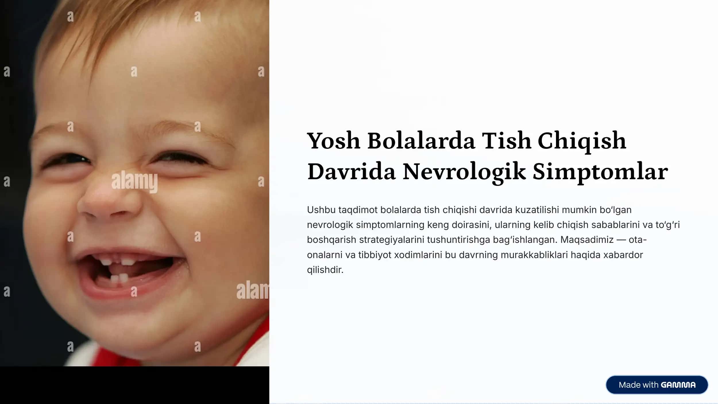 Yosh Bolalarda Tish Chiqish 
Davrida Nevrologik Simptomlar