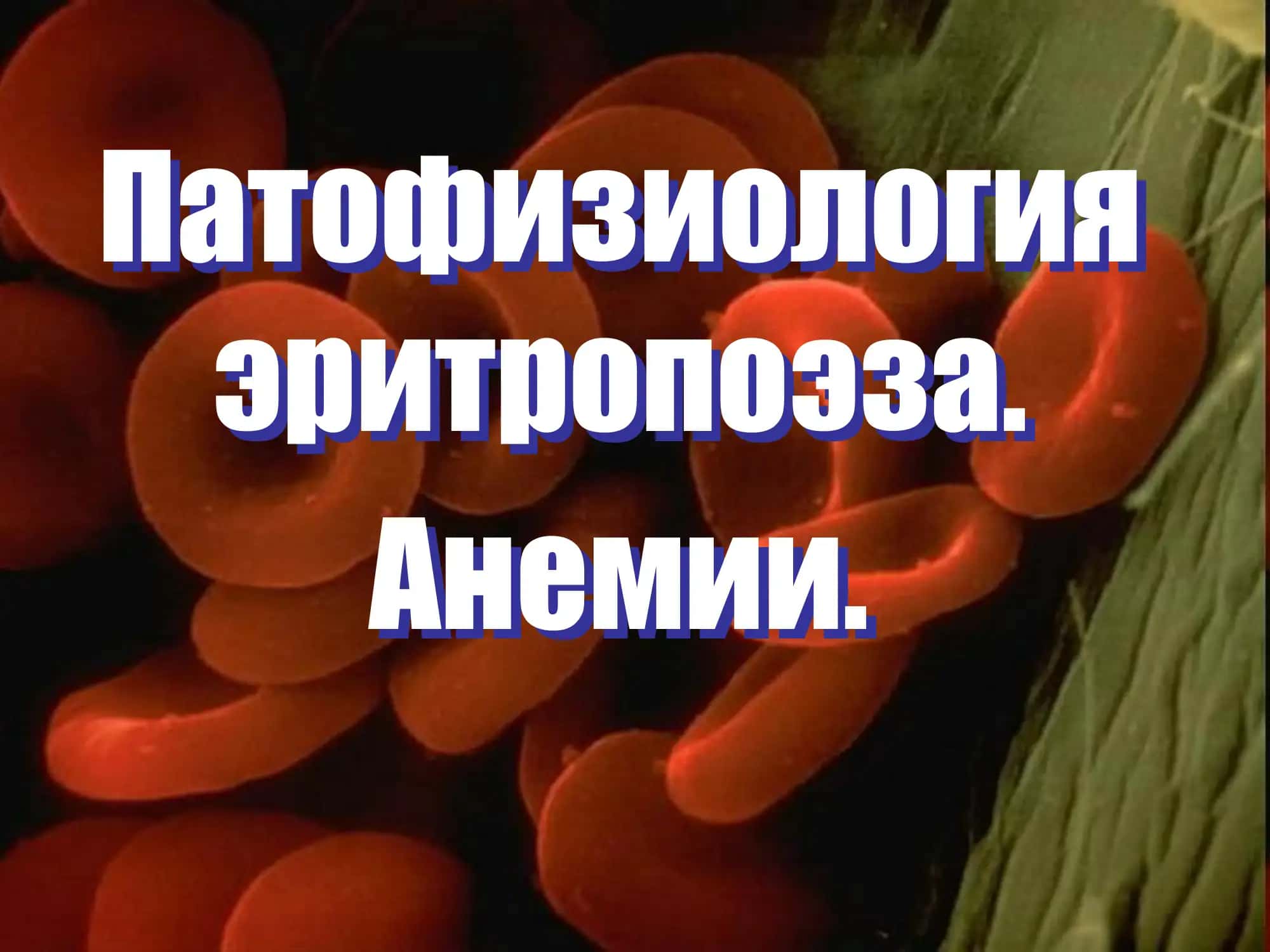 Патофизиология  эритропоэза.  Анемии.