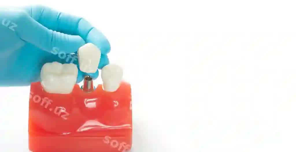 Yaqin rasmda qoʻl tutgan tish qurilmalari oq fond | Close up hand holding dental equipment against white background