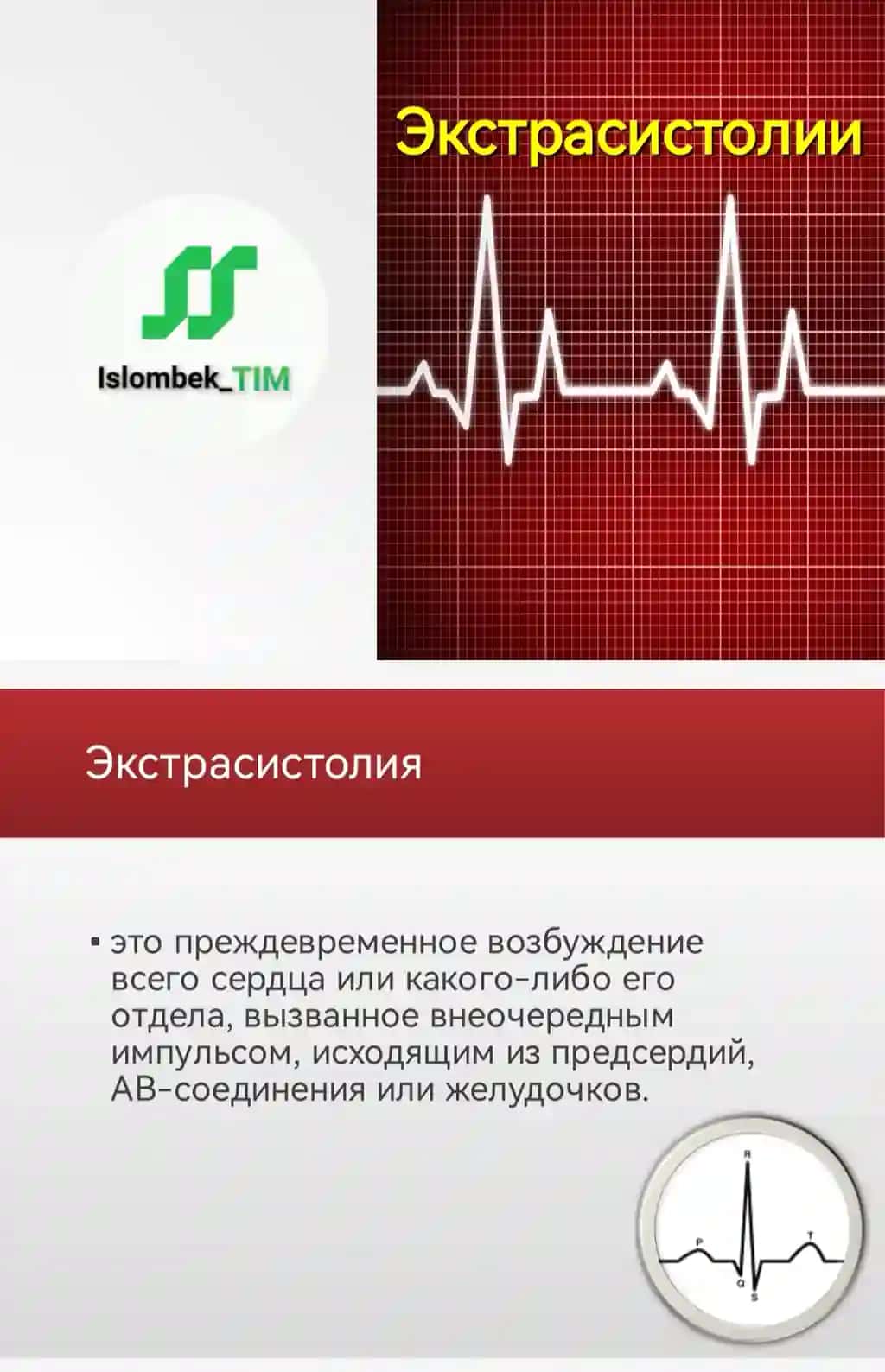 Экстрасистолии