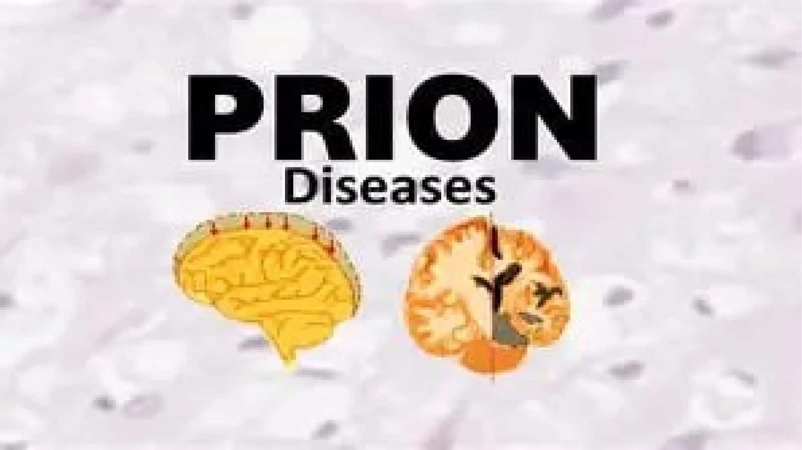 Prion Kasalliklari