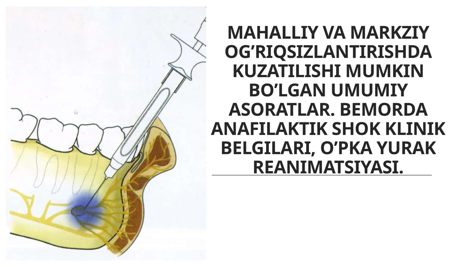 Stomatologiyada mahalliy va markaziy og‘riqsizlantirishda kuzatilishi mumkin bo‘lgan umumiy asoratlar