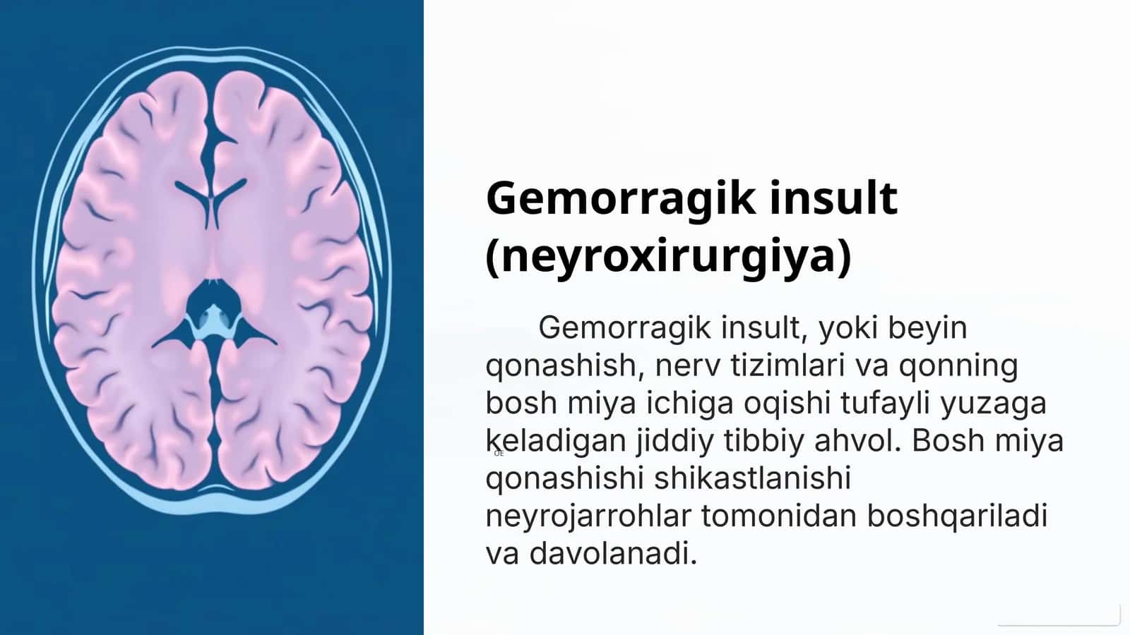 Gemorragik insult (neyroxirurgiya)