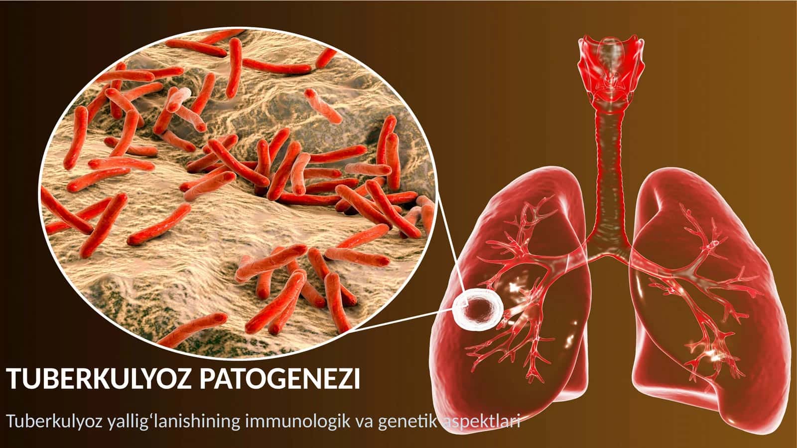 Tuberkulyoz patogenezi