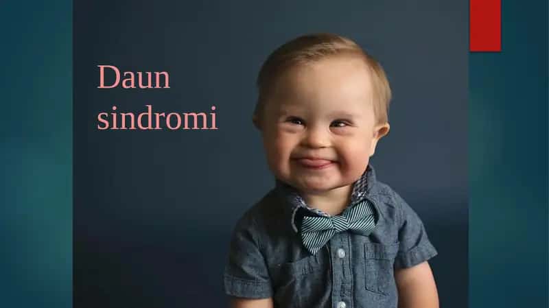 Daun sindromi