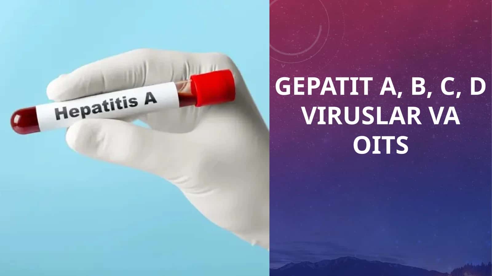 GEPATIT A, B, C, D VIRUSLAR VA OITS