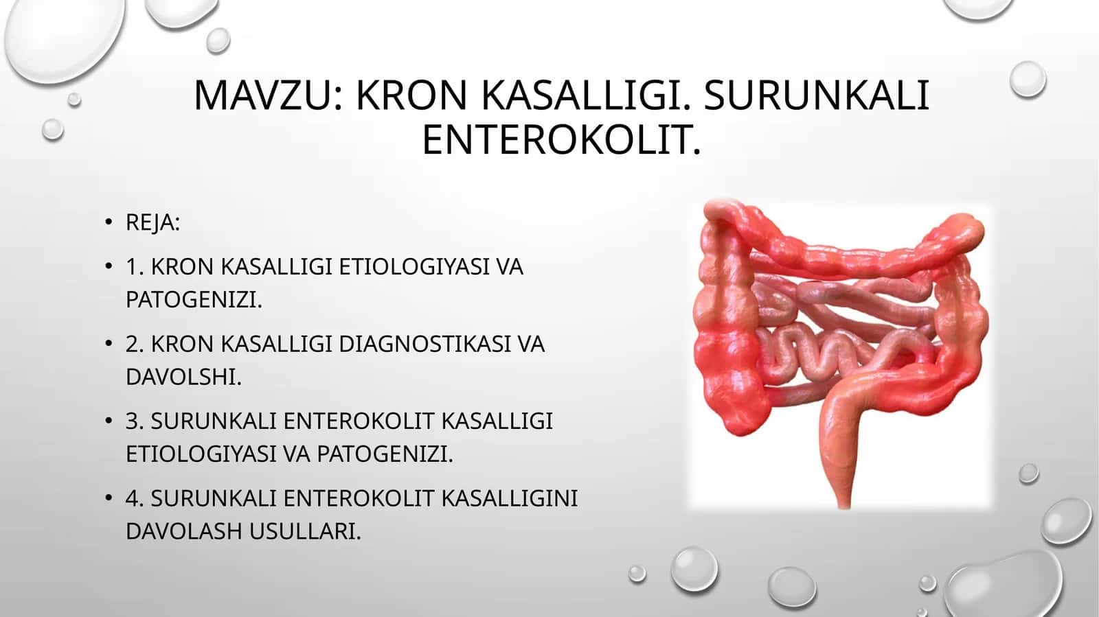 Kron kasalligi. Surunkali enterokolit