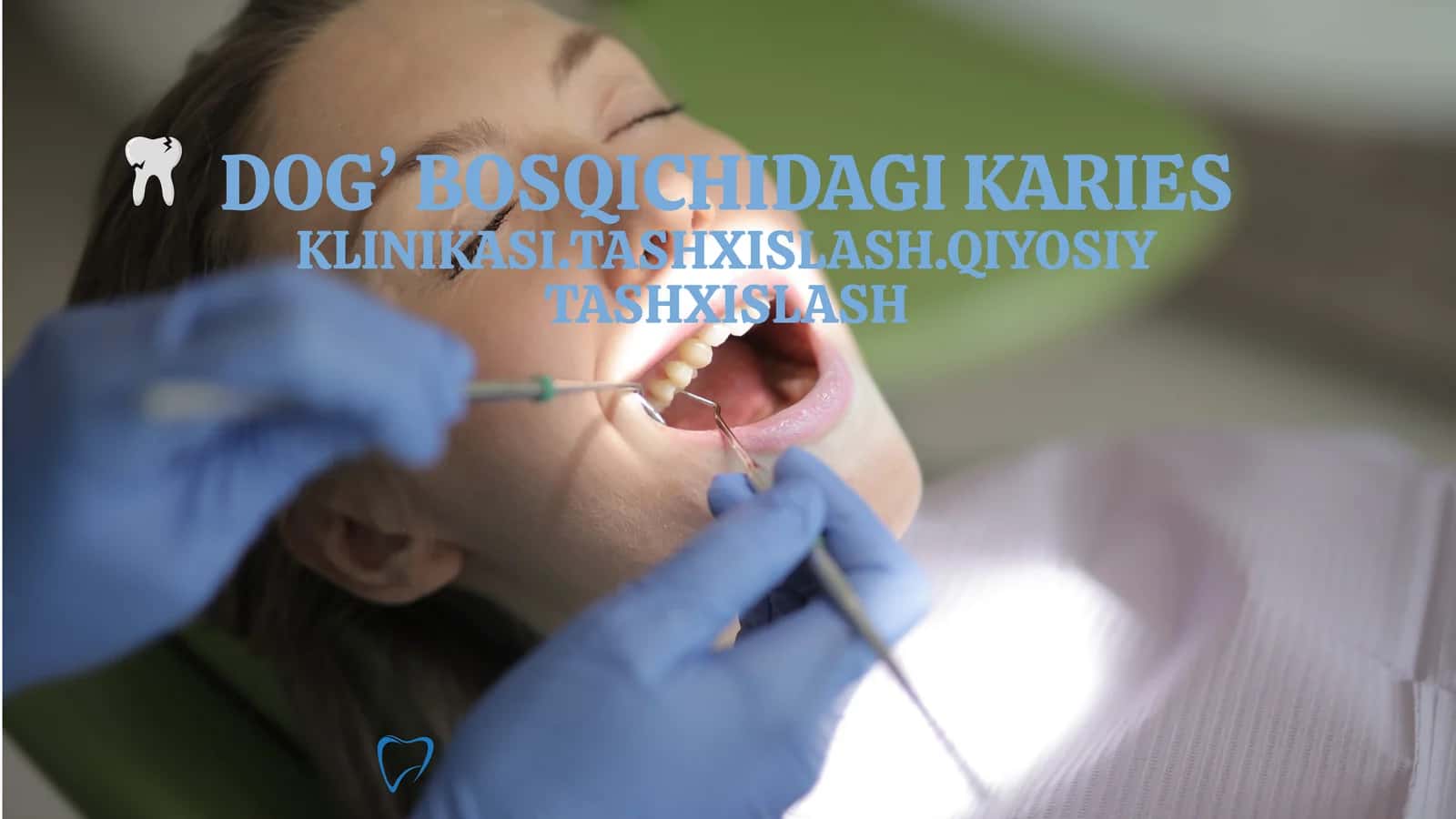 DOG’ BOSQICHIDAGI KARIES