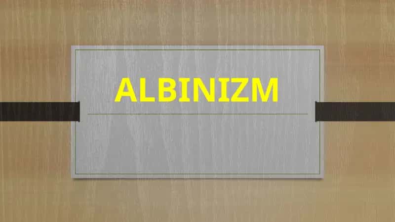 Albinizm