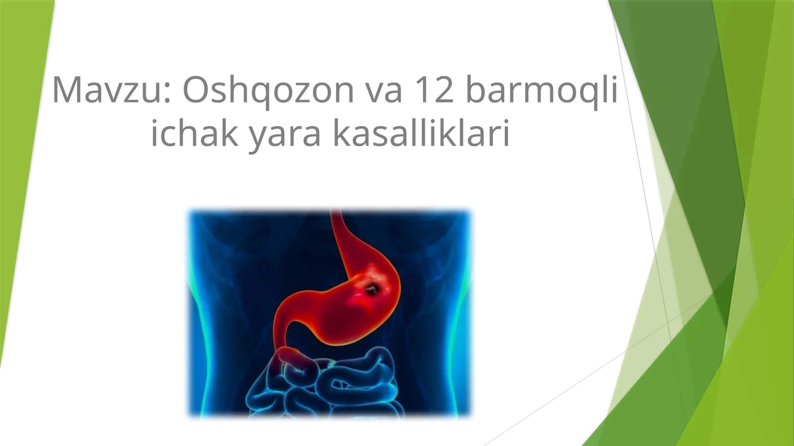 Oshqozon va 12 barmoqli ichak yara kasalliklari