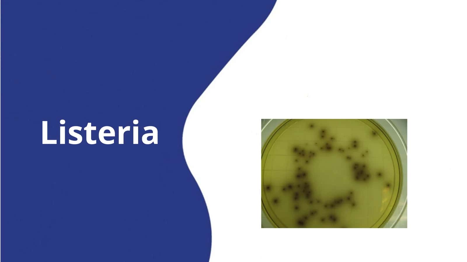 Listeria