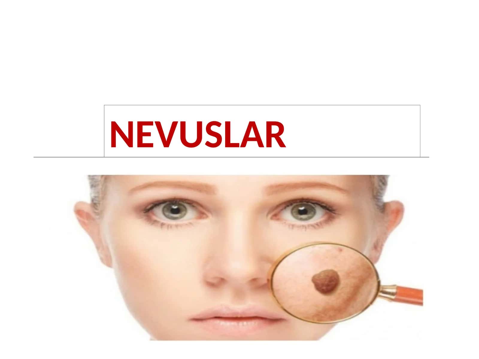 NEVUSLAR