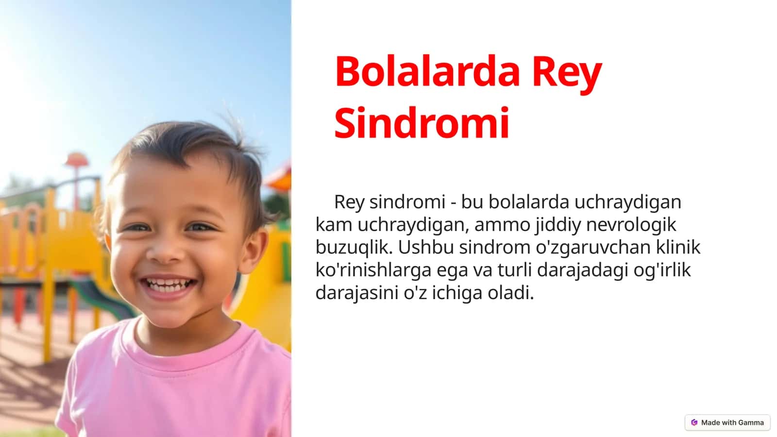 Bolalarda Rey Sindromi