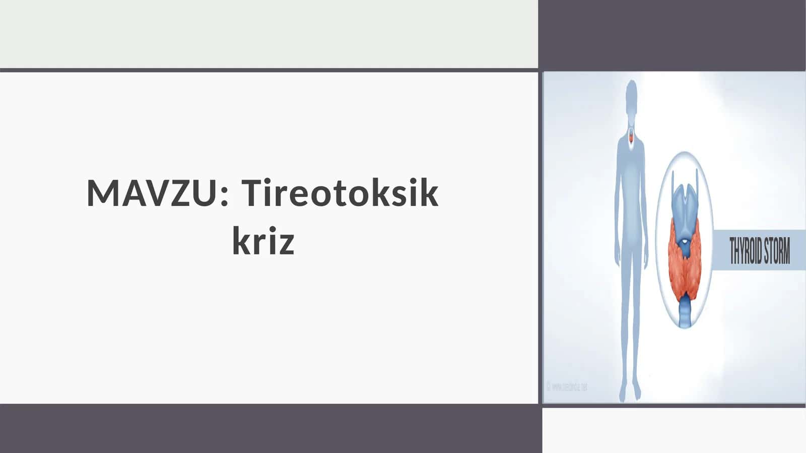 Tireotoksikkriz