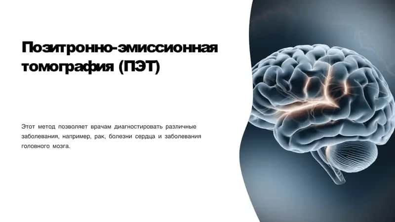 Позитронно-эмиссионная томография (ПЭТ)