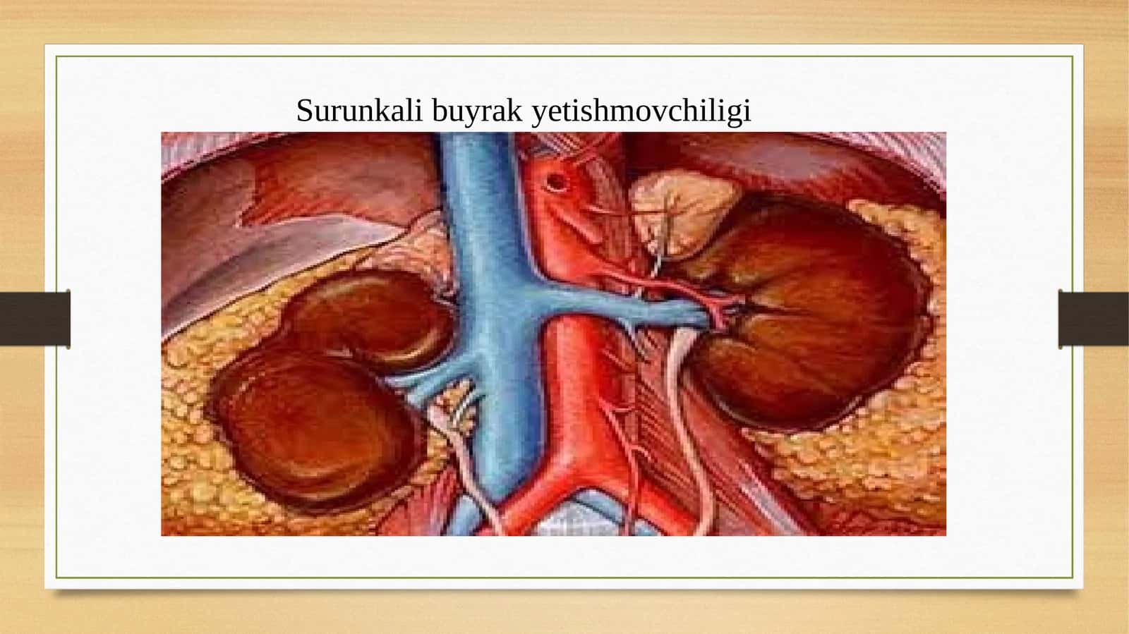 Surunkali buyrak yetishmovchiligi
