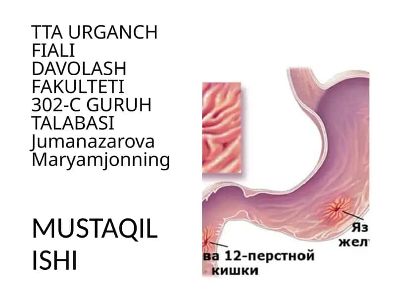 Surunkaligastrit