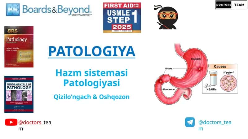 PATOLOGIYA Hazmsistemasi Patologiyasi