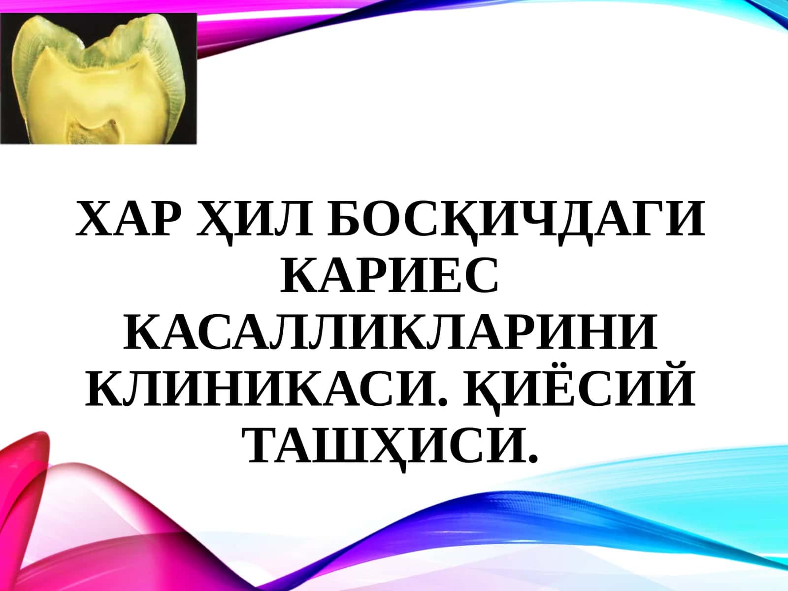 Тиш кариеси: қийосий ташхиси