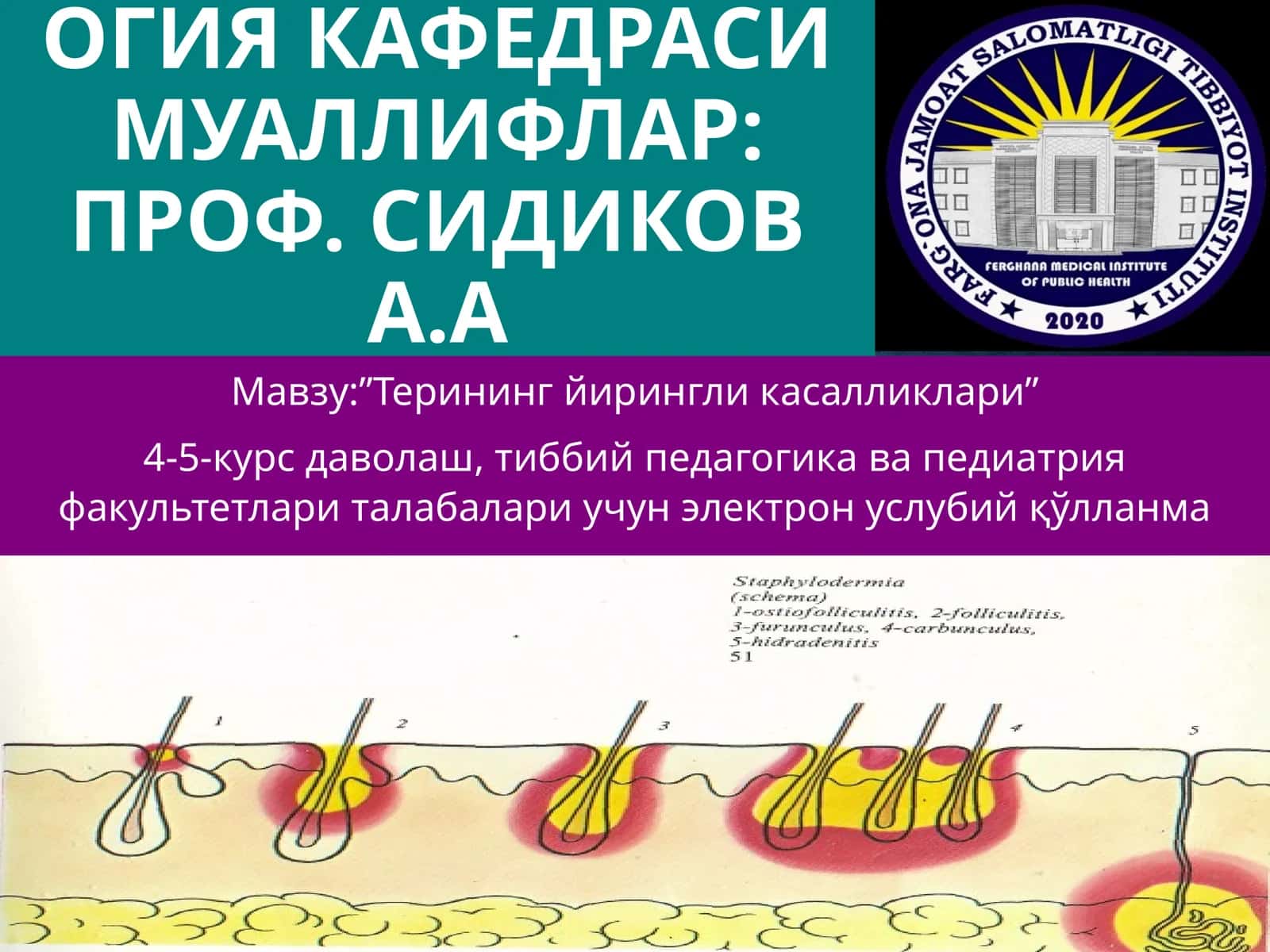 Терининг йирингли касалликлари-пиодермитлар