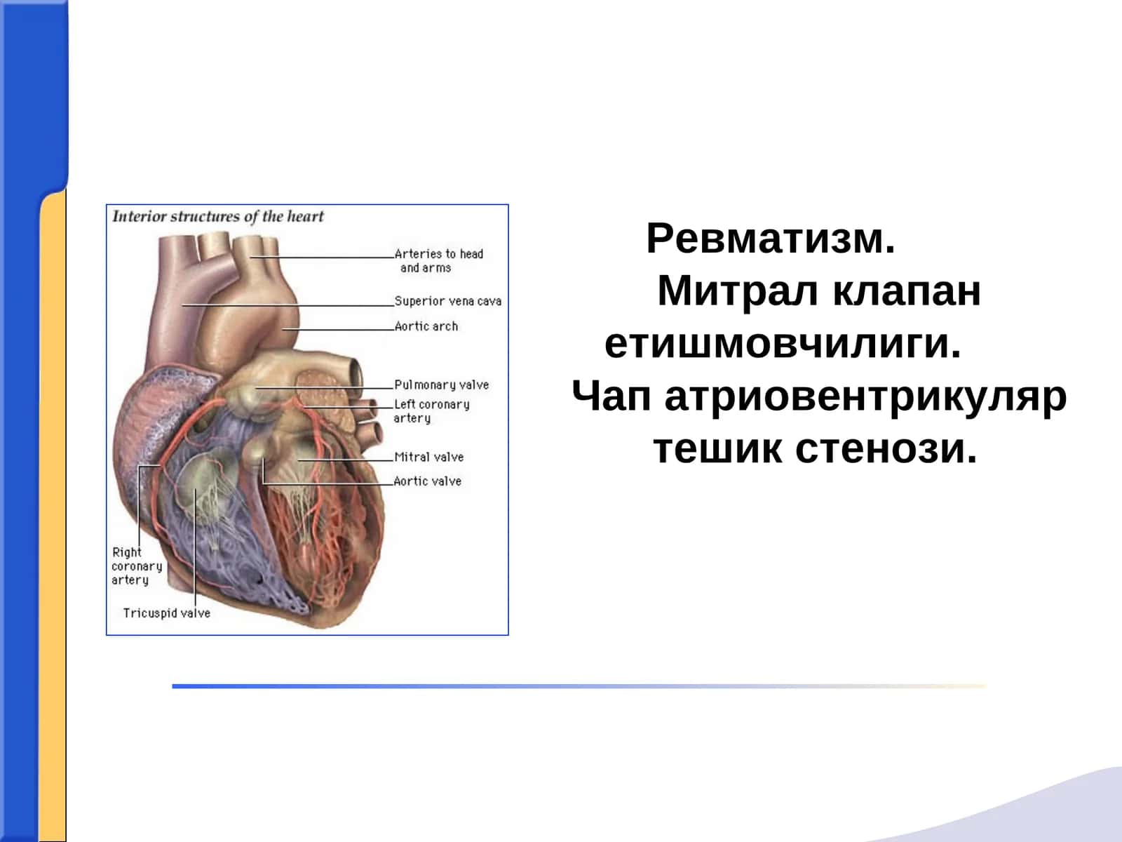 Revmatizm mitral klapan yetishmovchiligi chap atrioventrikulyar teshik stenozi