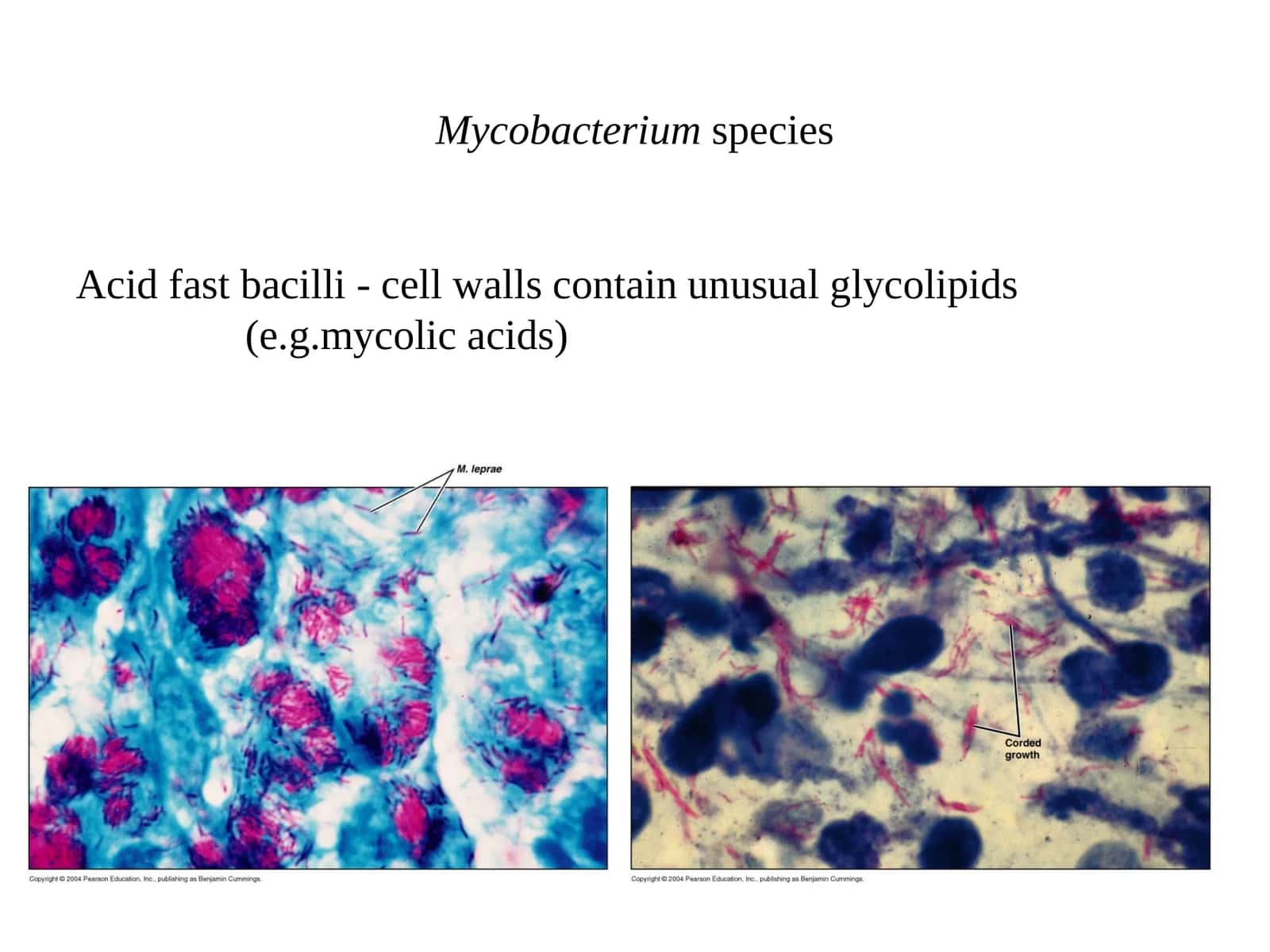 Mycobacterium species