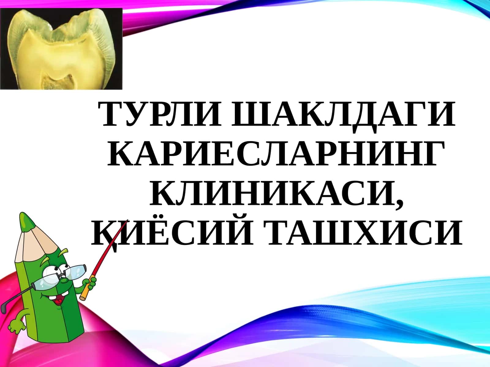Кариес этиологияси