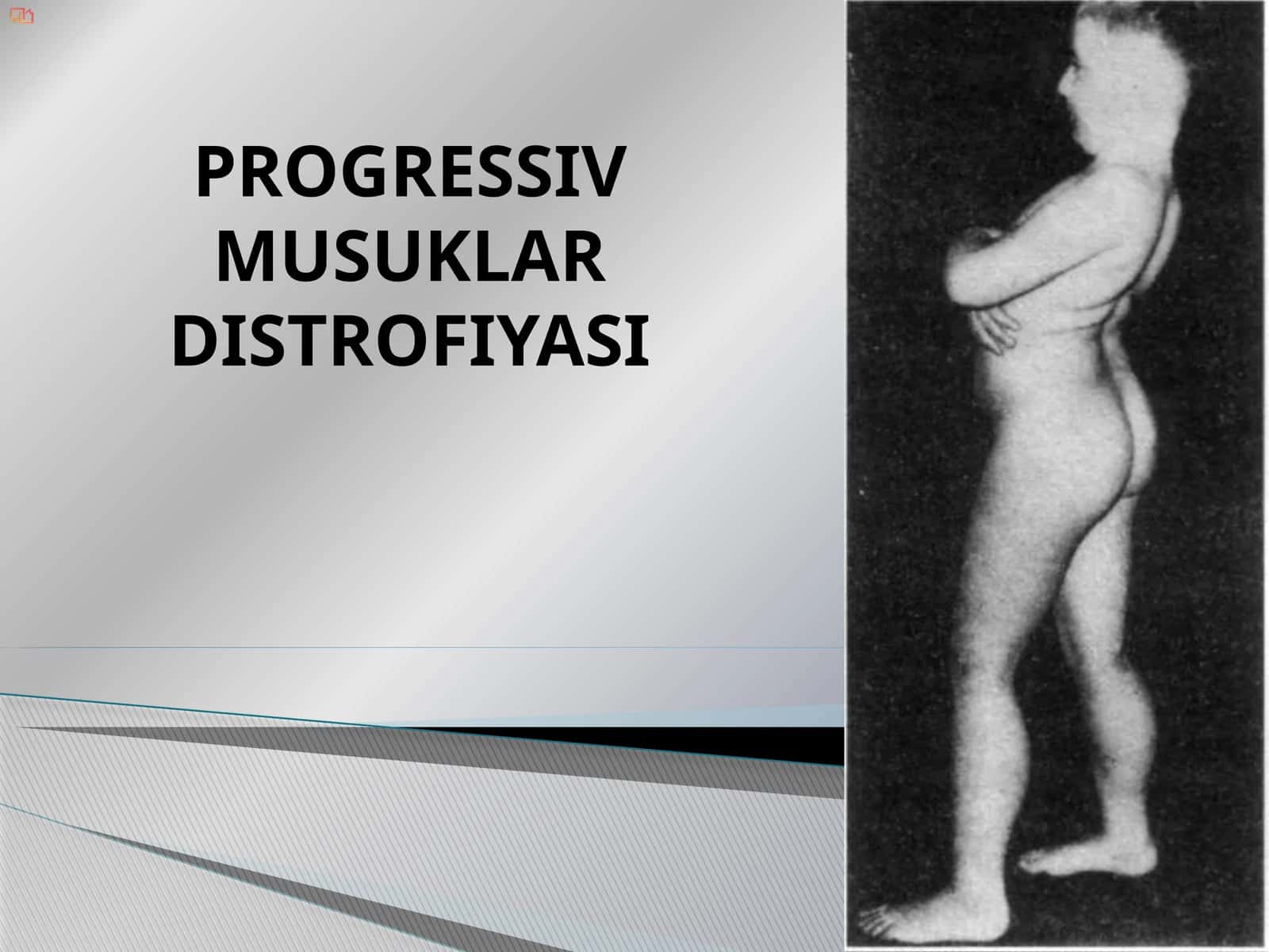 Progressiv Mushaklar Distrofiyasi