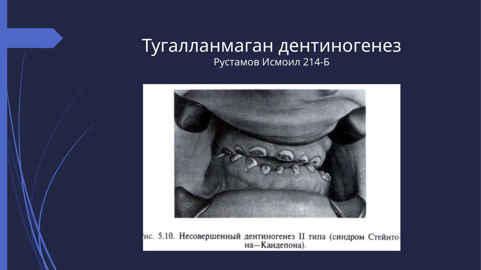 ТугалланмагандентиногенезРустамовИсмоил214-Б