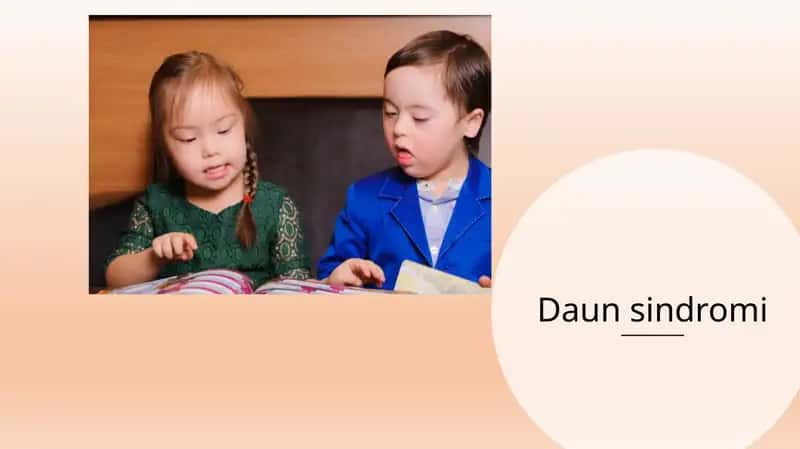 Daun sindromi
