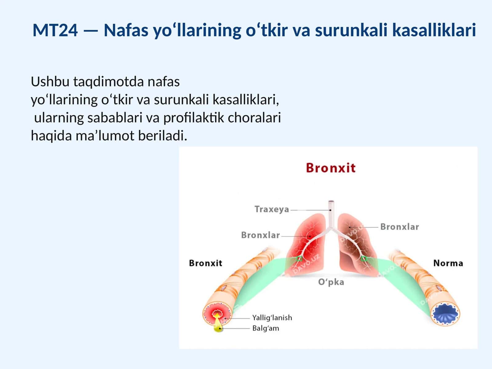 MT24 —Nafasyo‘llariningo‘tkirvasurunkalikasalliklari