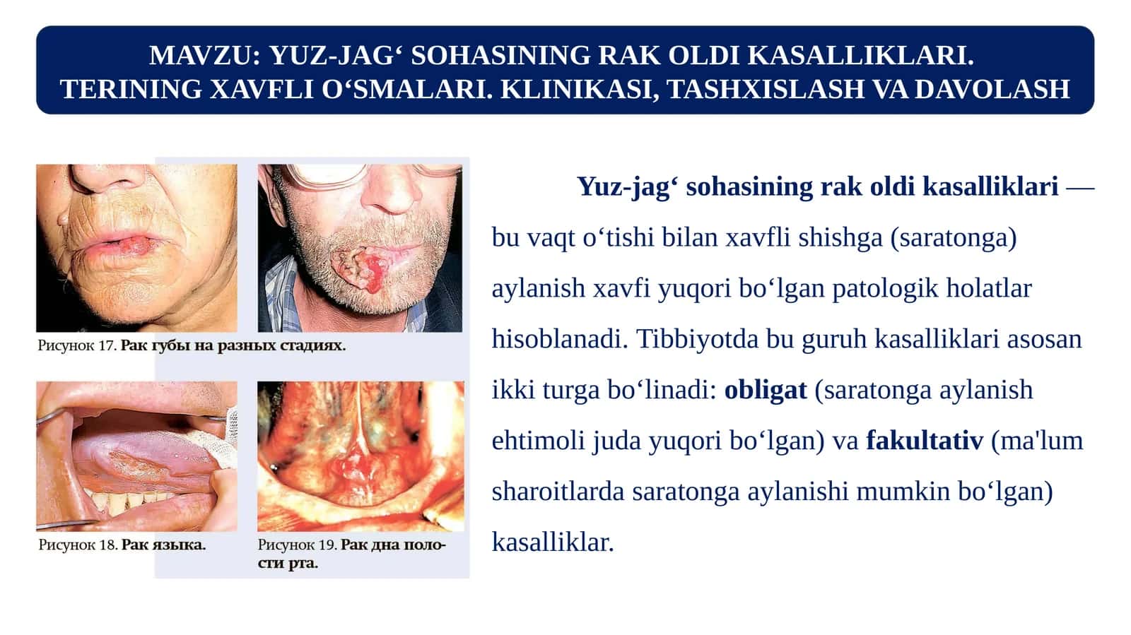 MAVZU:YUZ-JAG‘ SOHASINING RAK OLDI KASALLIKLARI