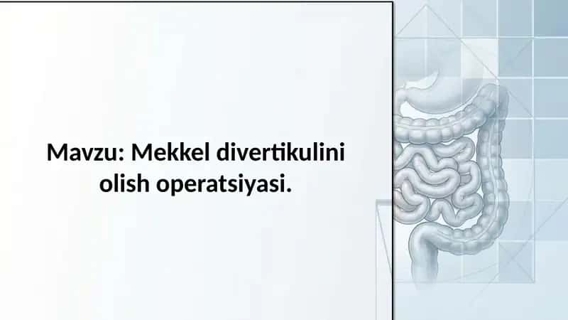 Mekkel divertikulini olish operatsiyasi