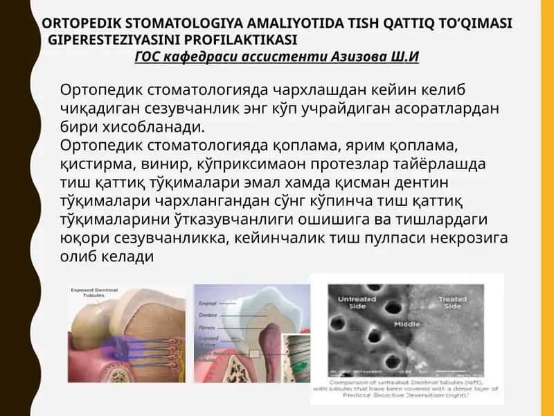 Ортопедик стоматологияда тиш қаттиқ тўқимаси