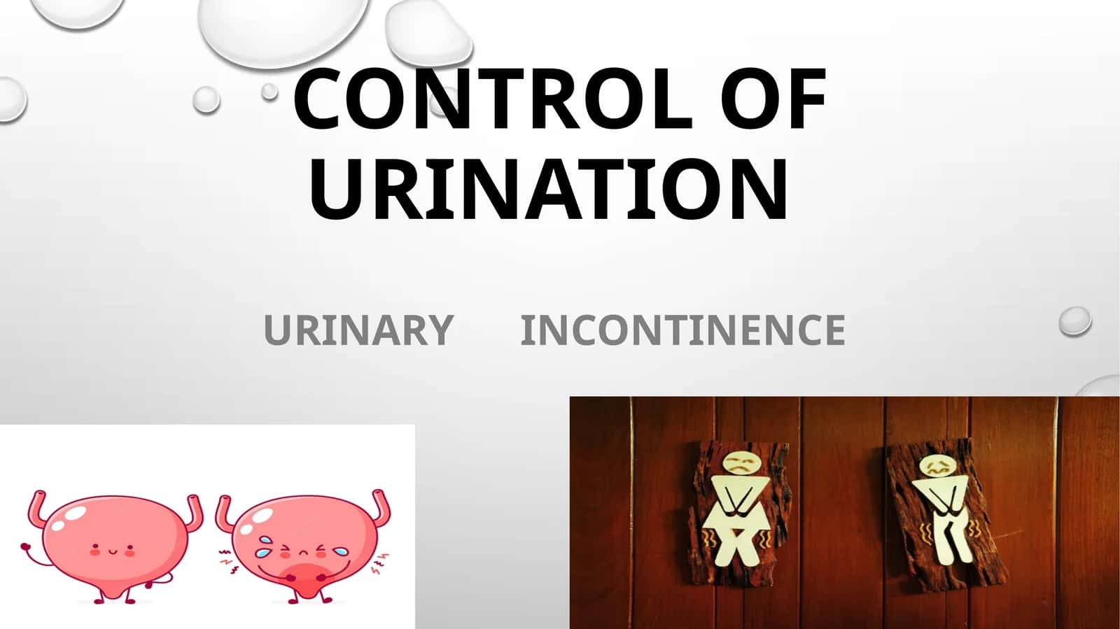 URINARY INCONTINANCE