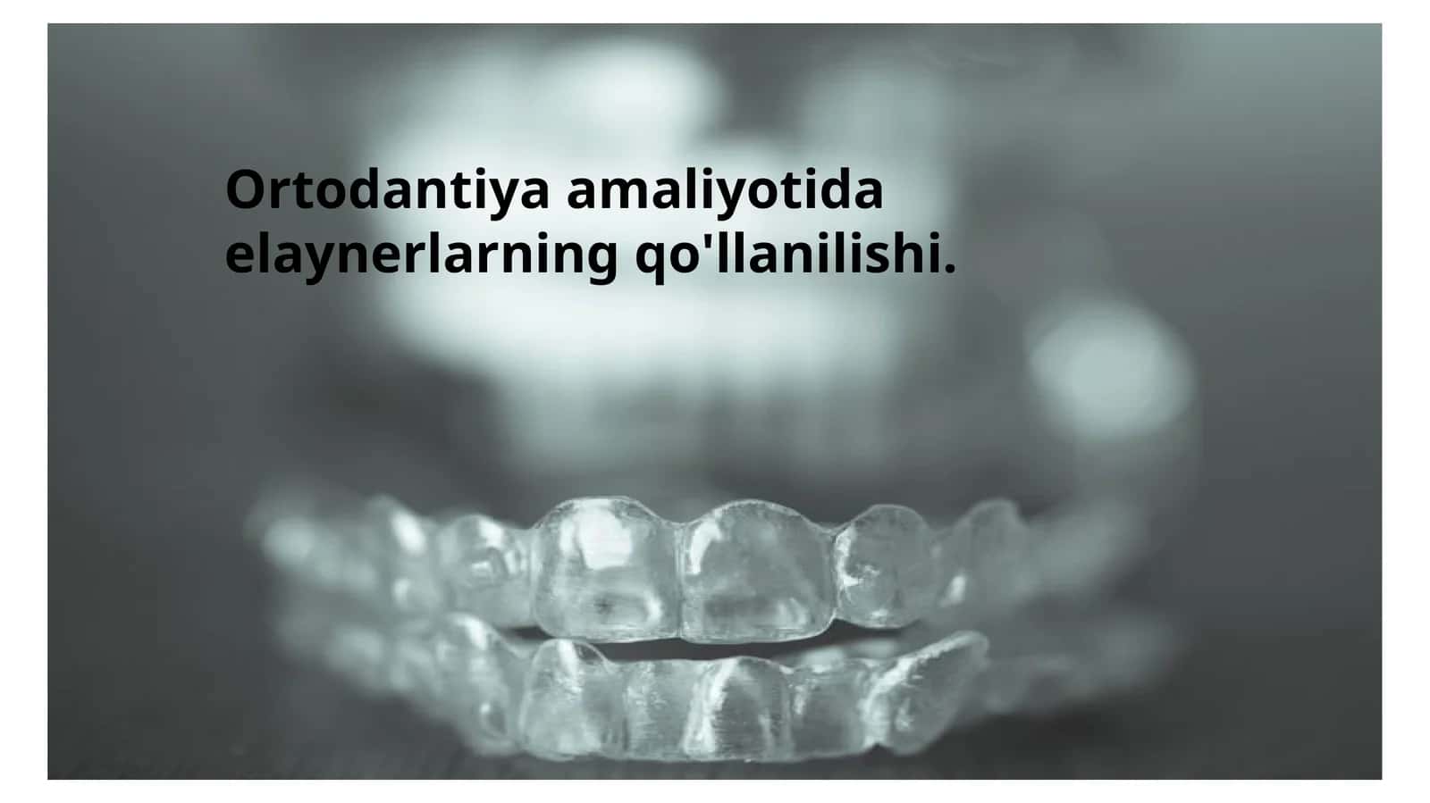 Elaynerlar
