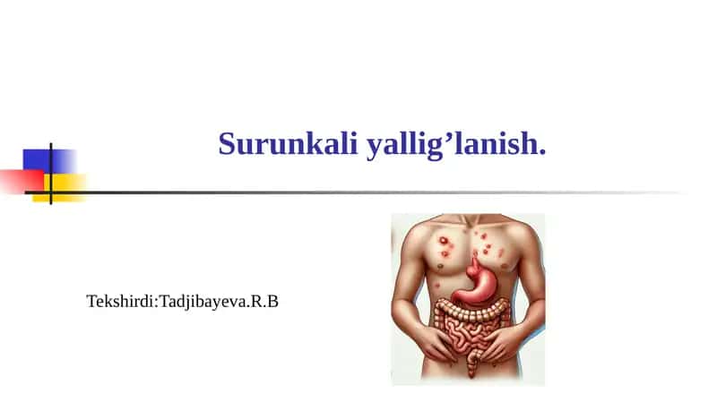 Surunkaliyallig’lanish