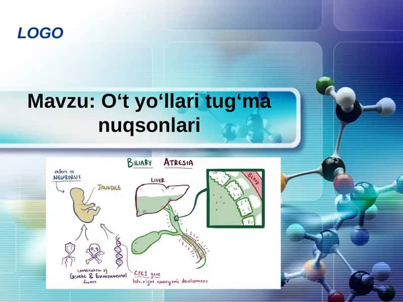 O‘t yo‘llari tug‘ma nuqsonlari
