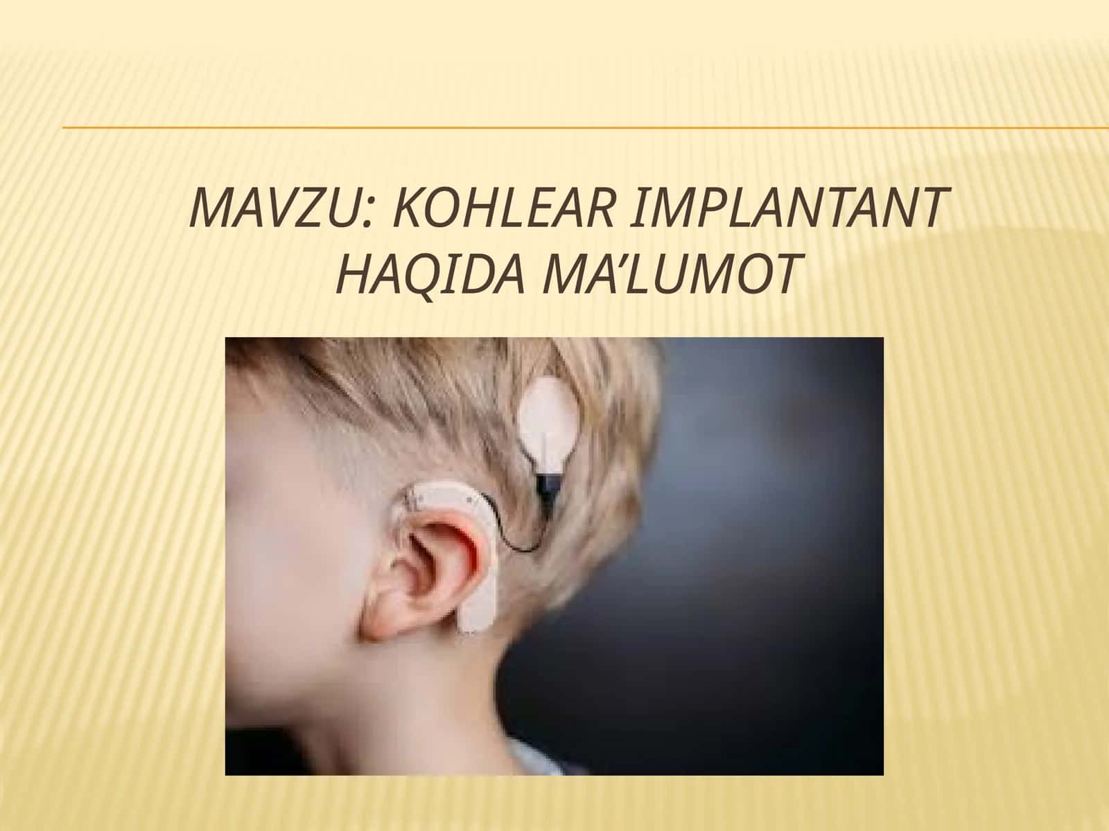 Kohlear implantant