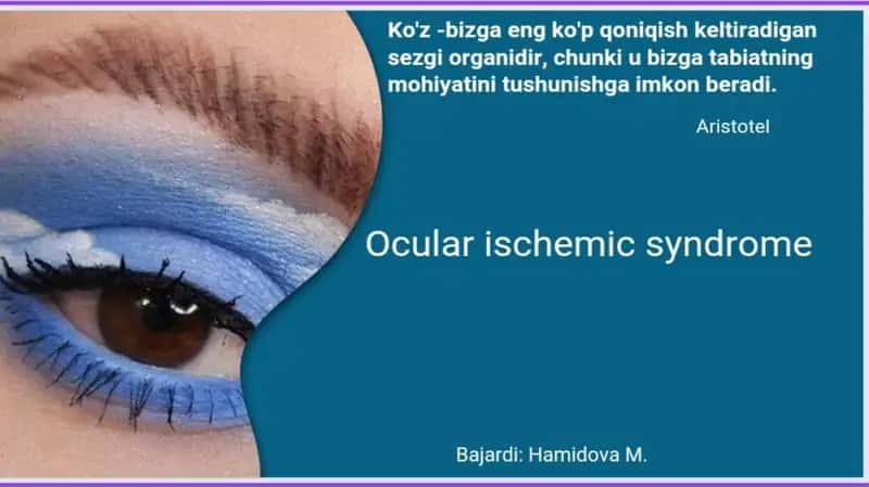 Og'ir ipsilateral yoki ikki tomonlama uyqu arteriyasi stenozi