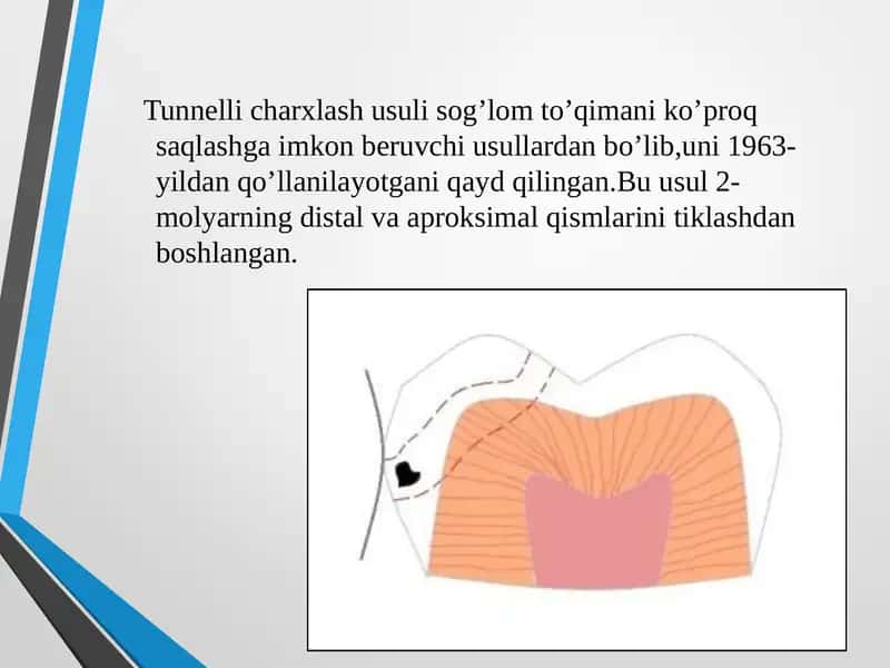 Tunnellicharxlash usuli