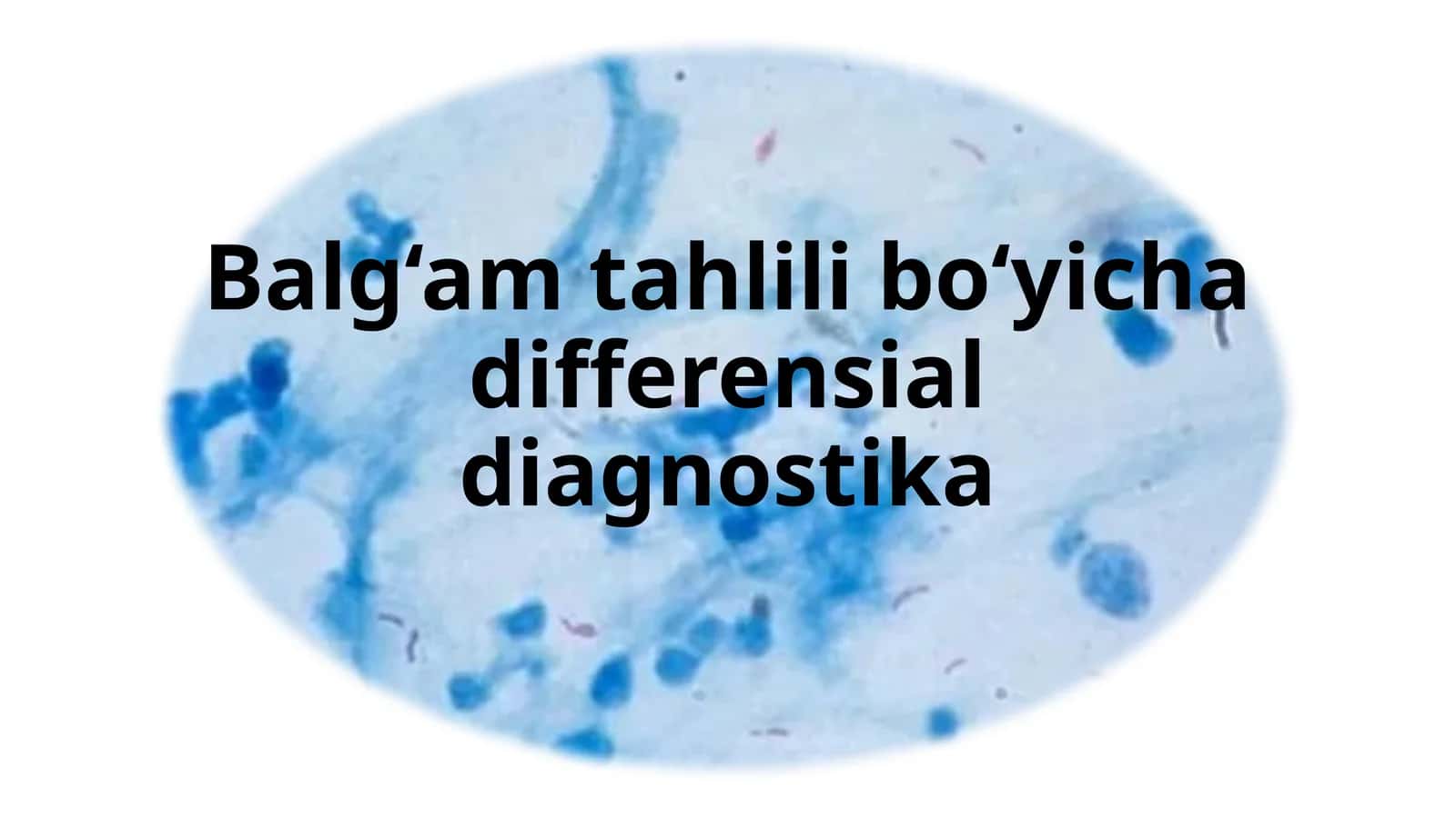 Balg‘am bo‘yicha differensial diagnostika