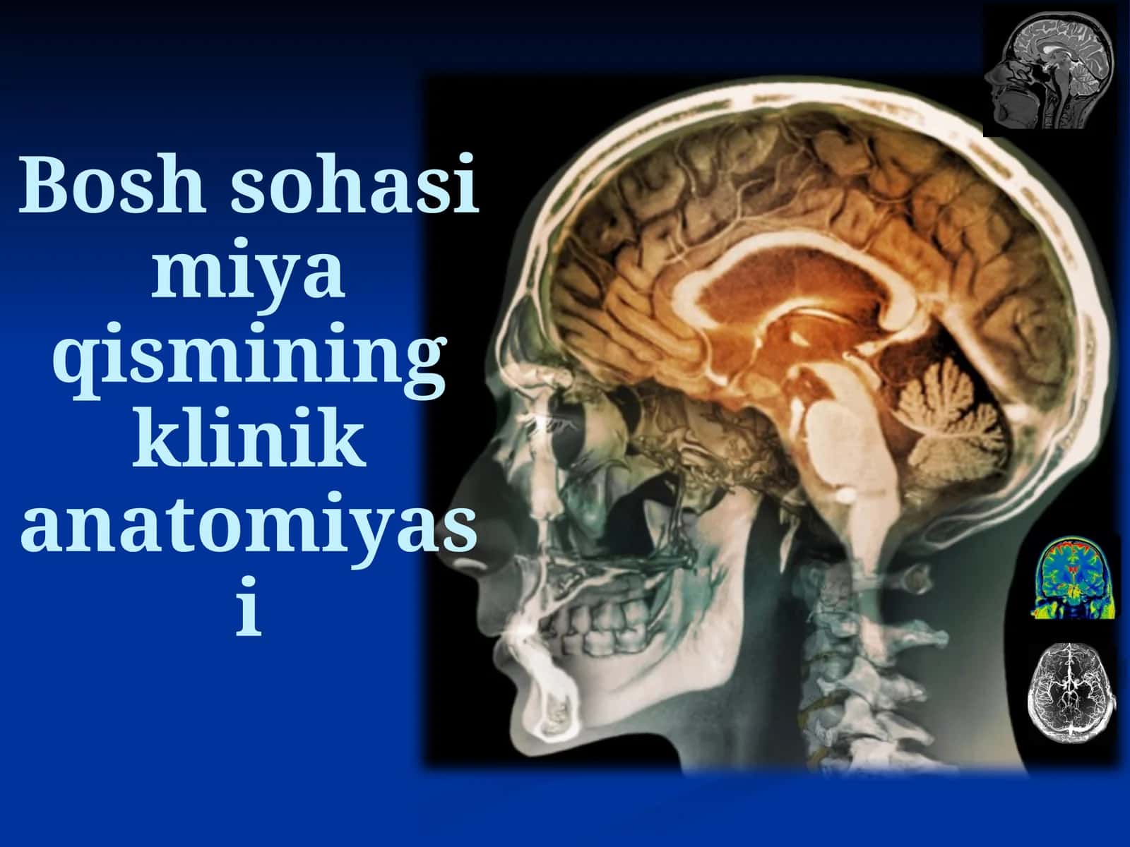 Bosh sohasi miya qismining klinik anatomiyasi