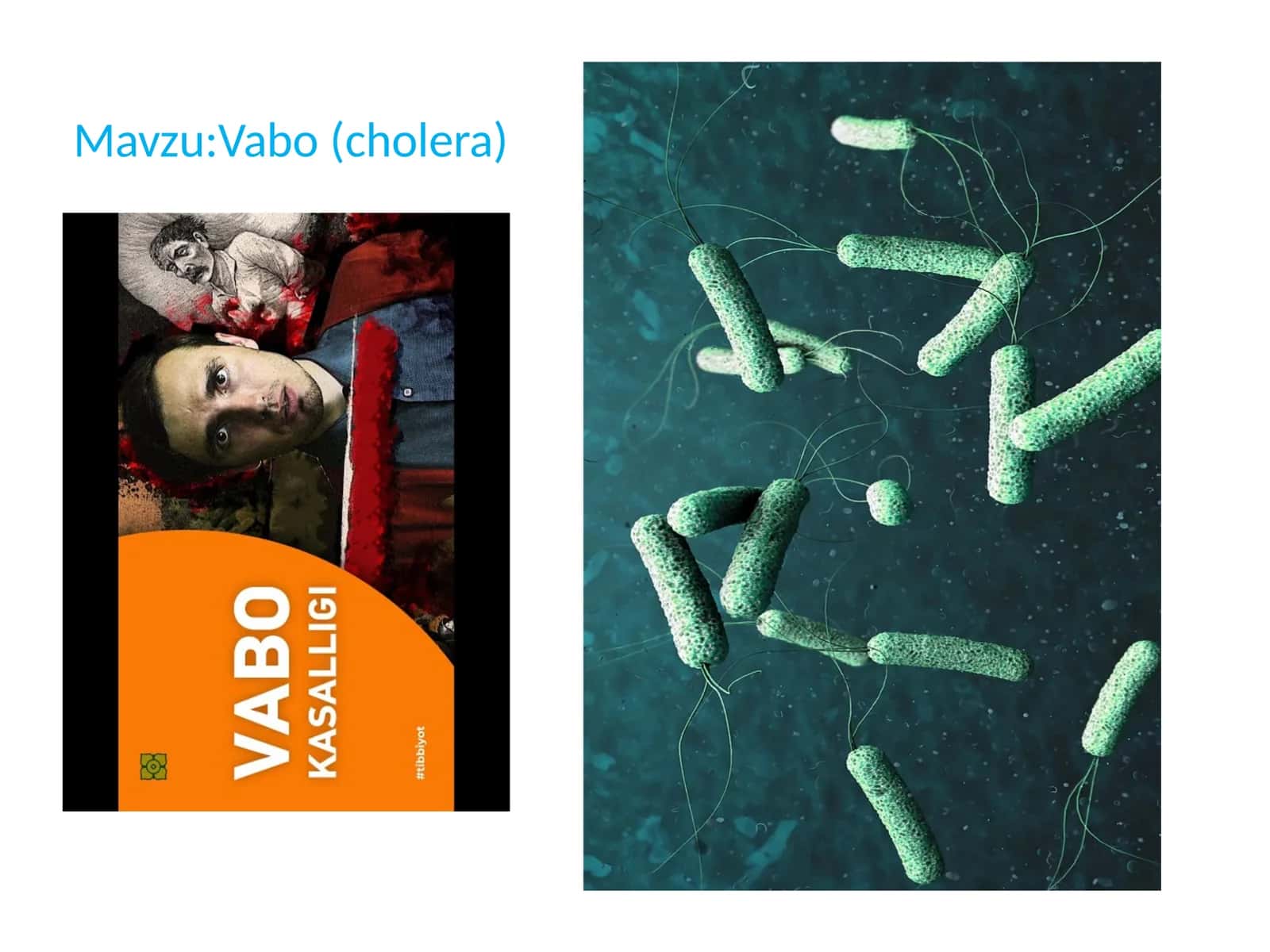 Vabo (cholera)