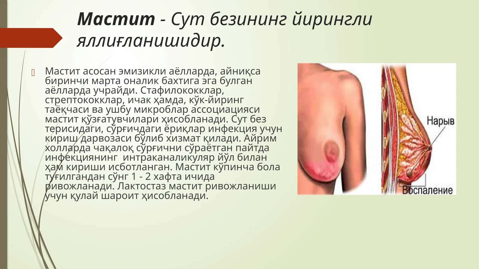 Мастит-Сутбезининг йирингли яллиғланиши