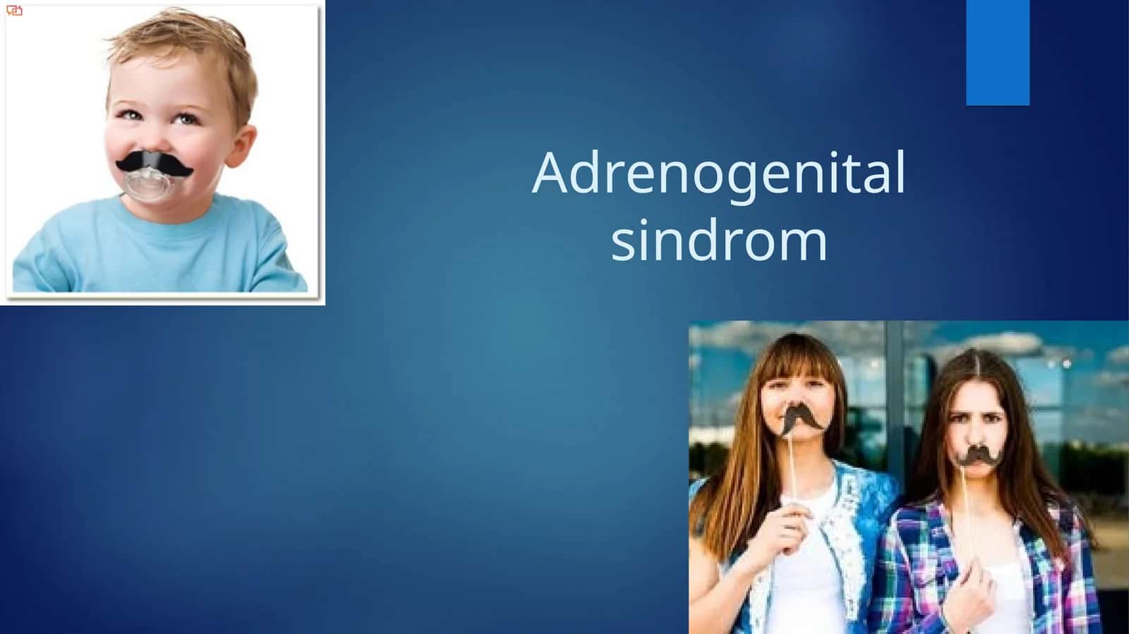 Adrenogenital sindrom