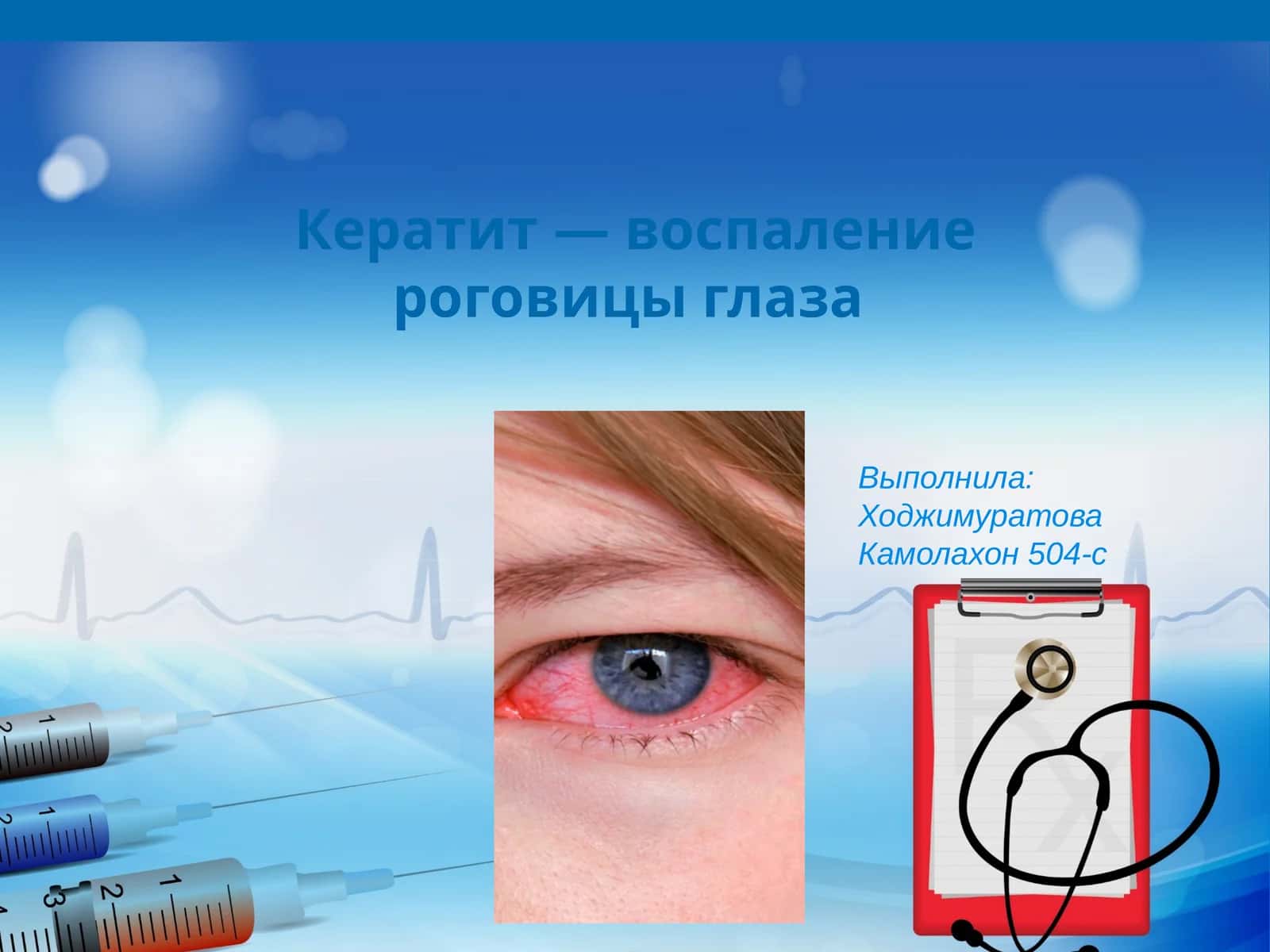 Кератит — воспаление роговицы глаза