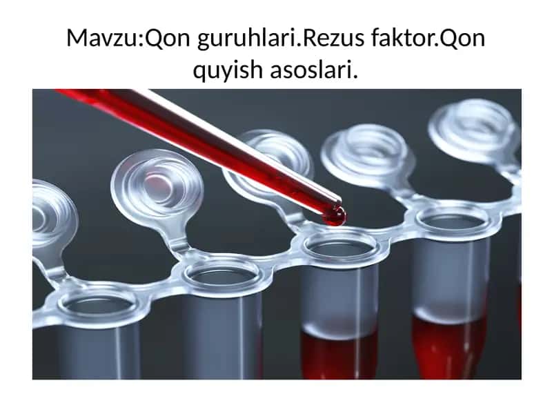 Qon guruhlari.Rezus faktor.Qon quyish asoslari